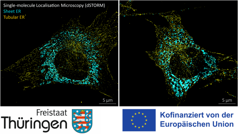Dual-Color Single-Molecule Localization Microscopy (SMLM) of tubular (yellow) and sheet (cyan) ER in fixed cells.